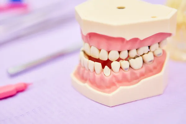 TMD and Your Bite: What the Evidence Actually Says
