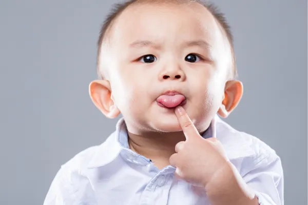 The Frenectomy Frenzy: Why Tongue-Tie Surgery Isn’t the Answer for TMD or Sleep Apnea