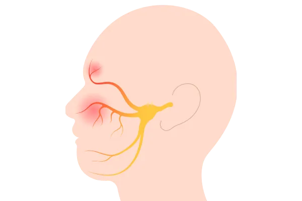 No, Your Dental Work Did Not Cause Trigeminal Neuralgia. But It's Often Misdiagnosed As Dental Pain.