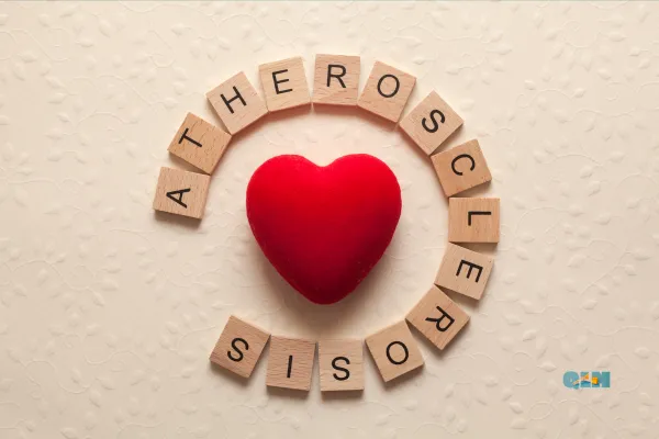 Why Inflammation—Not Just Cholesterol—Drives Heart Disease

