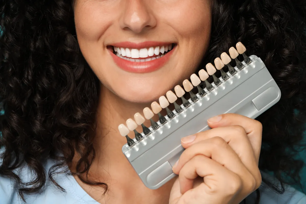 When to Get Veneers: Everything You Need to Know Before Deciding