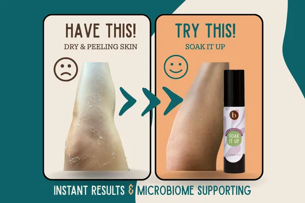 Dry & Peeling Skin Relief!