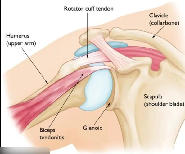 Older adult holding their shoulder with stiffness while standing at home, showing limited range of motion consistent with arthritis-related shoulder pain