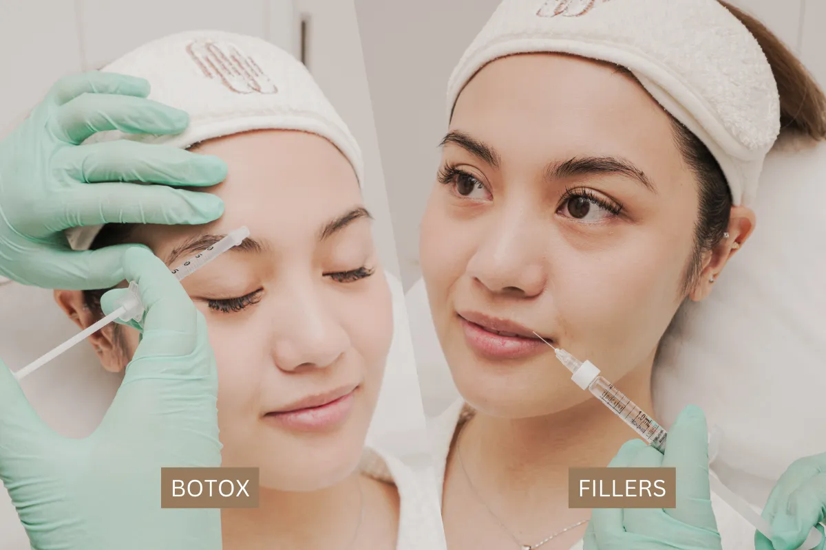 Botox vs. Filler: Which Treats Your Lines Best?
