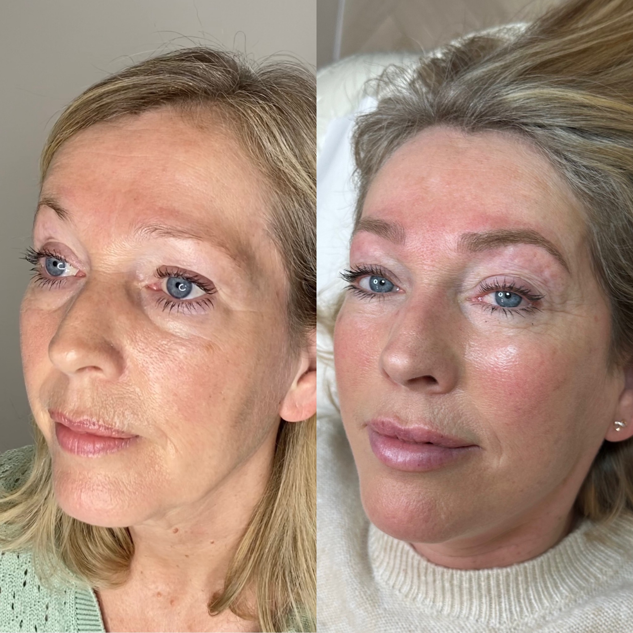 Natural microblading at heaven sent clinics in wilmslow