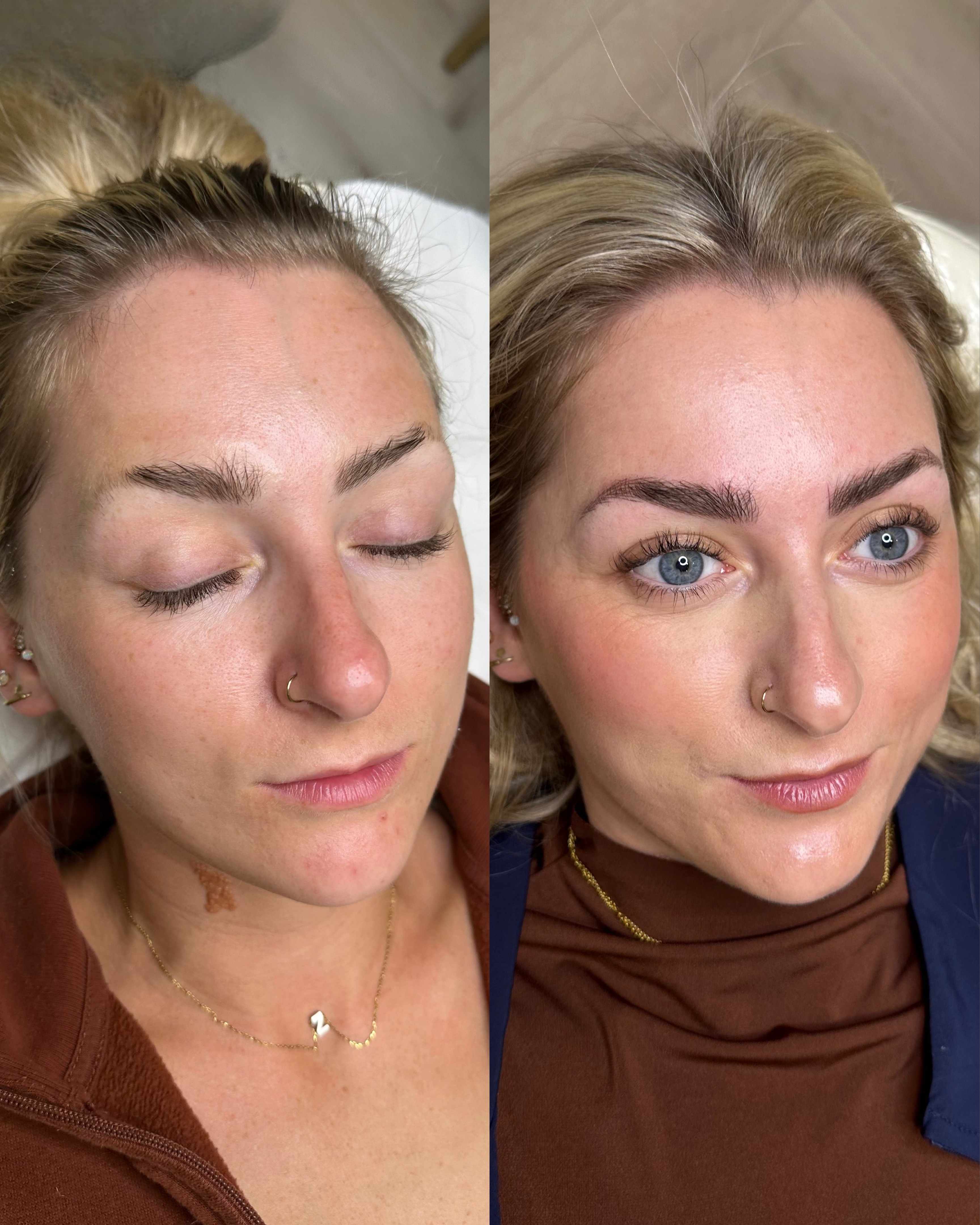 eyebrow transformation for hair loss in cheshire