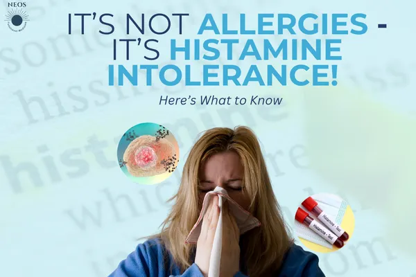 Histamine Intolerance