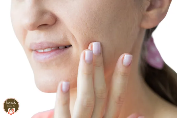 How to Treat Acne Scars: Best Treatments and Prevention Tips