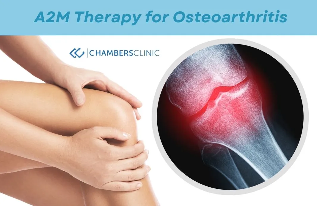 What is A2M and how is it different than PRP?
