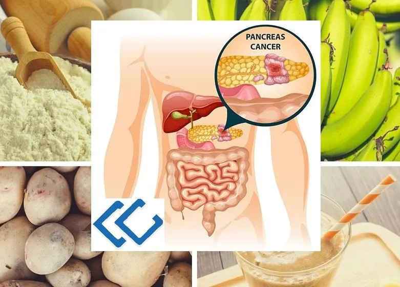 Resistant Starch and Pancreatic Cancer