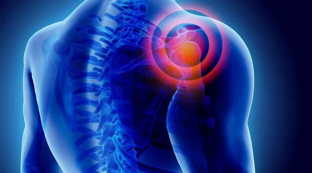 Low-Impact Workouts to Relieve Shoulder Pain and Improve Mobility