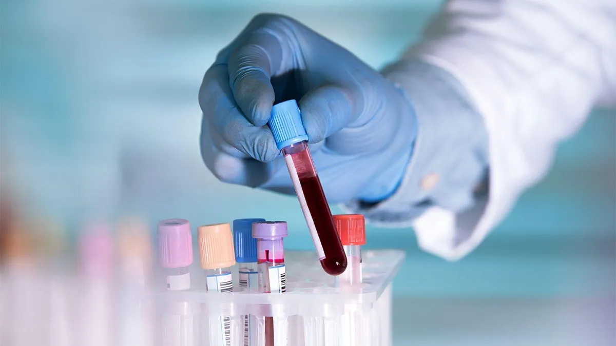 Liquid Biopsies for Cancer Screening: What You Need to Know