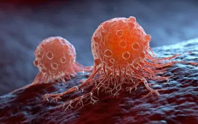 Relación del Cáncer y la Trombosis Venosa Profunda (TVP)