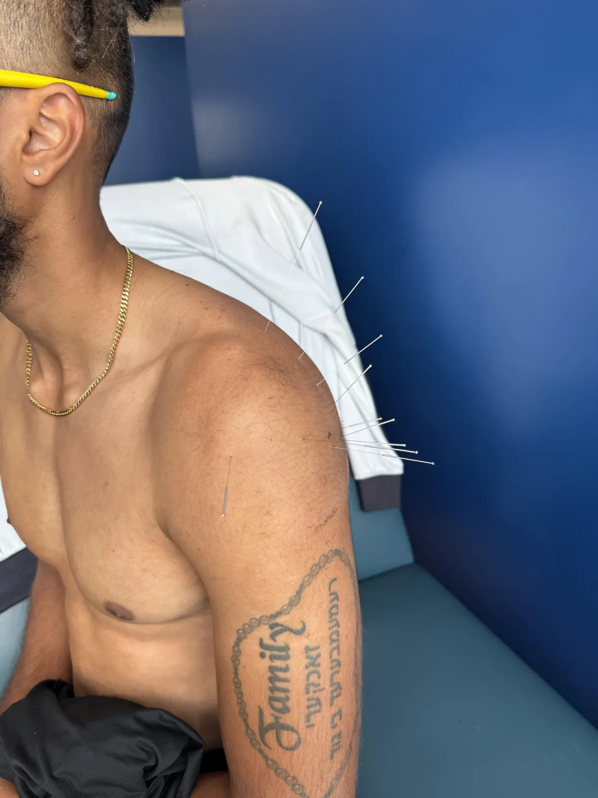 Rotator cuff Physical Therapy