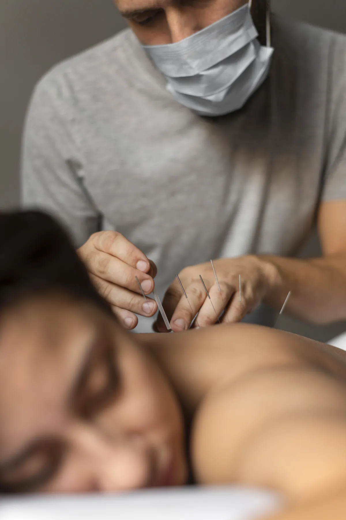 Dry Needling in Physical Therapy: Restoring Mobility and Reducing Pain