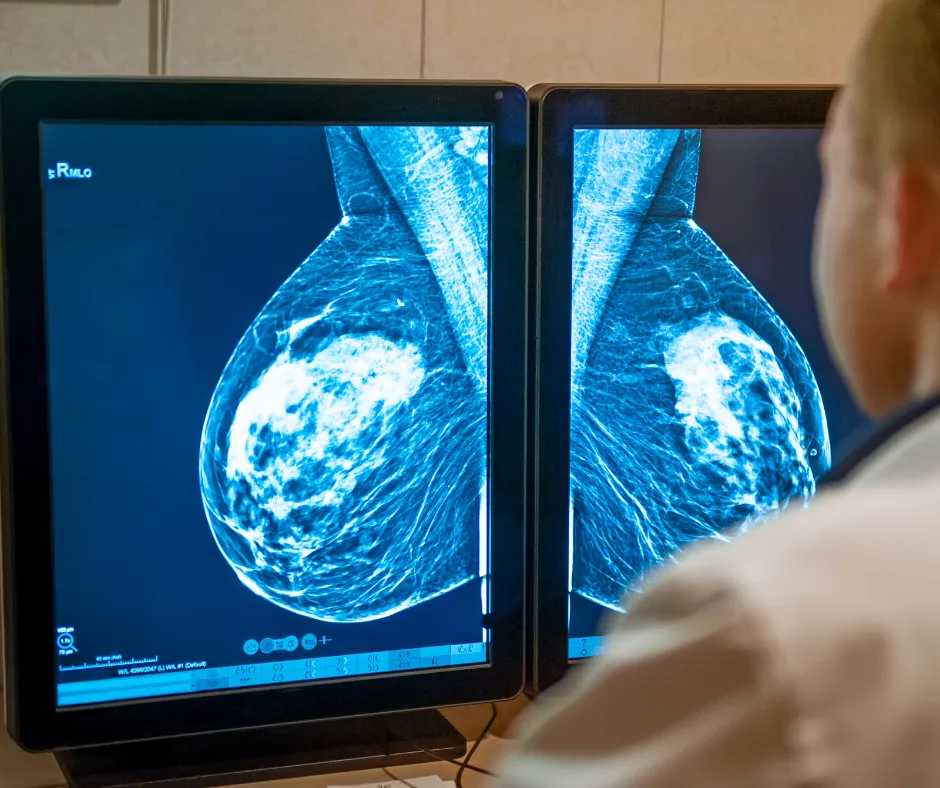 mammogram