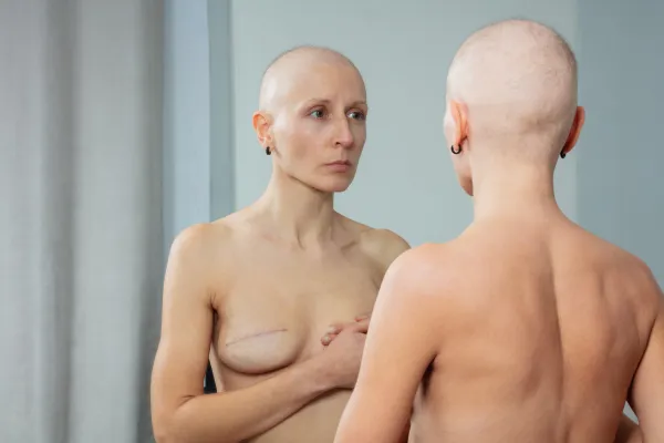 mastectomy hair loss mirror