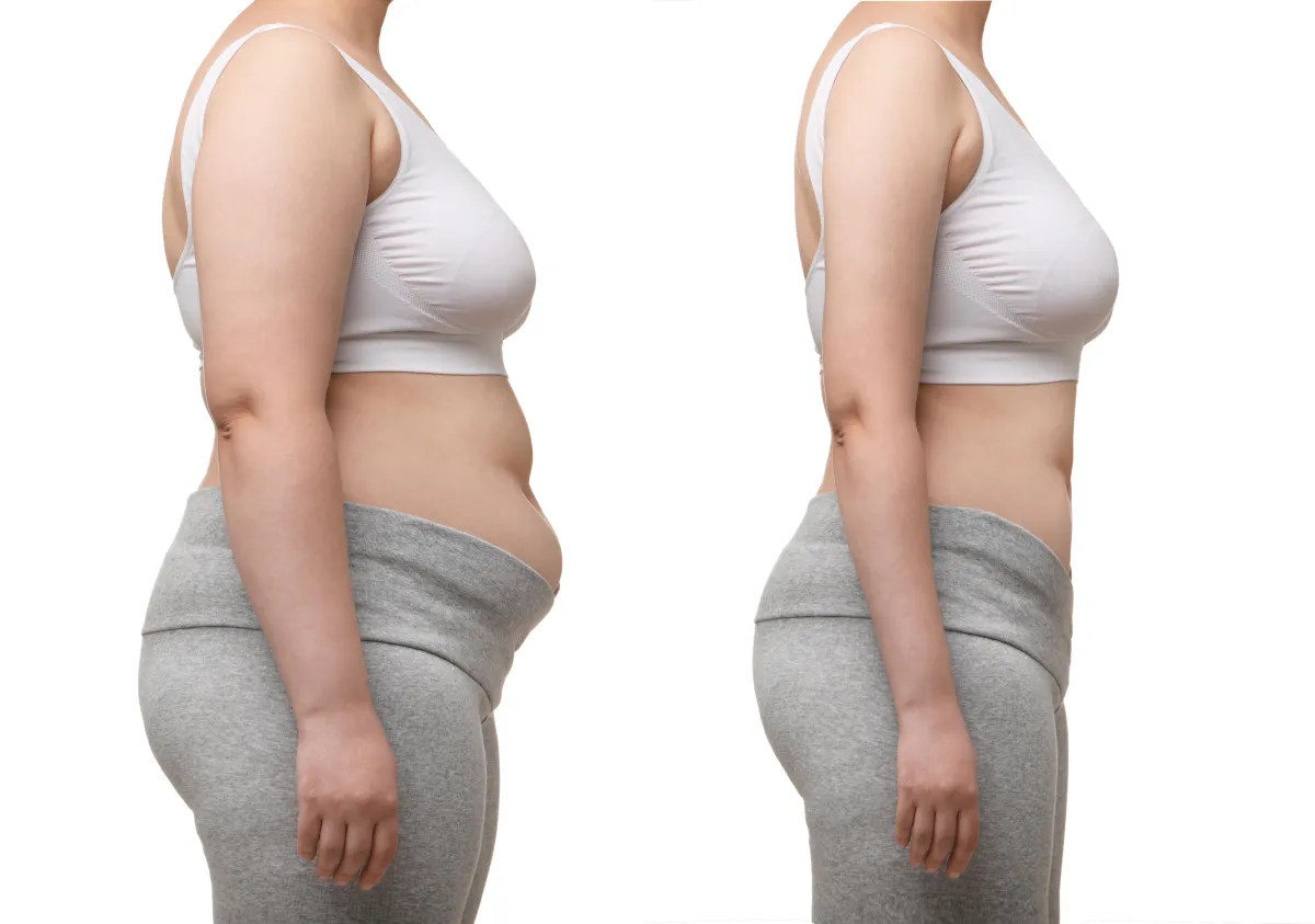 Weight loss