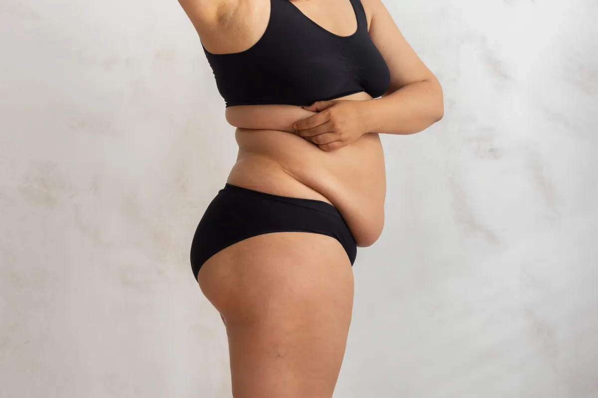 loose skin