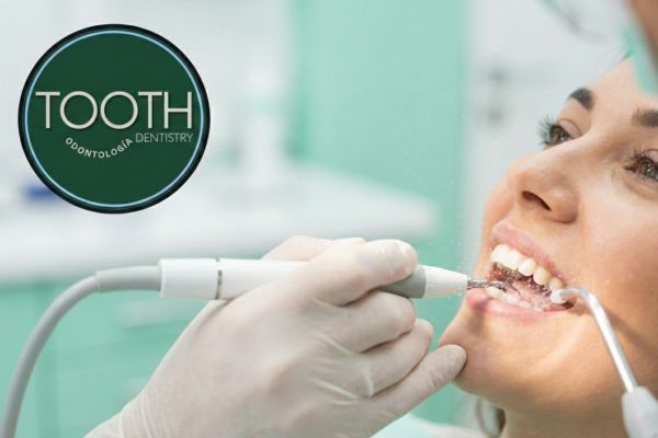 Logo de Tooth Dentistry Sabaneta sobre imagen de limpieza dental profesional en clínica odontológica integral cerca al Parque de Sabaneta