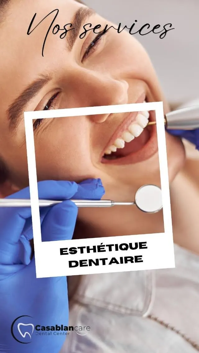 Esthetique dentaire