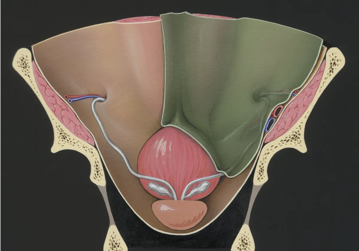 Did you know that 1 in 10 women suffer from endometriosis?