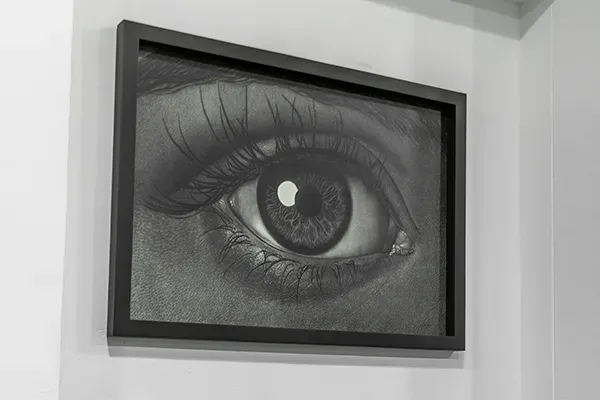 Por qué pacientes internacionales eligen a Carriazo