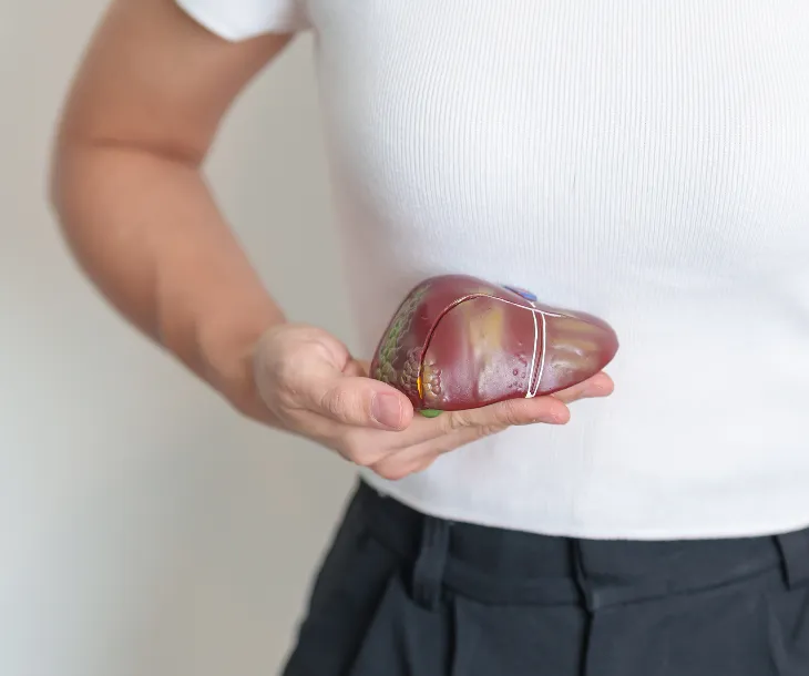 El hígado graso es una enfermedad de origen metabólico y es 100% reversible