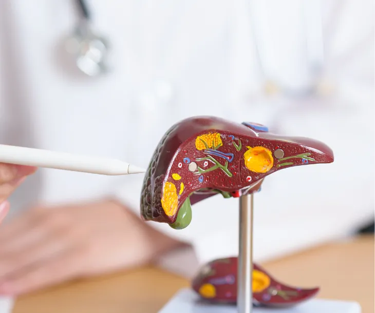 Persona mostrando el hígado graso