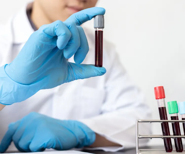 Persona midiendo los niveles de glucosa en sangre