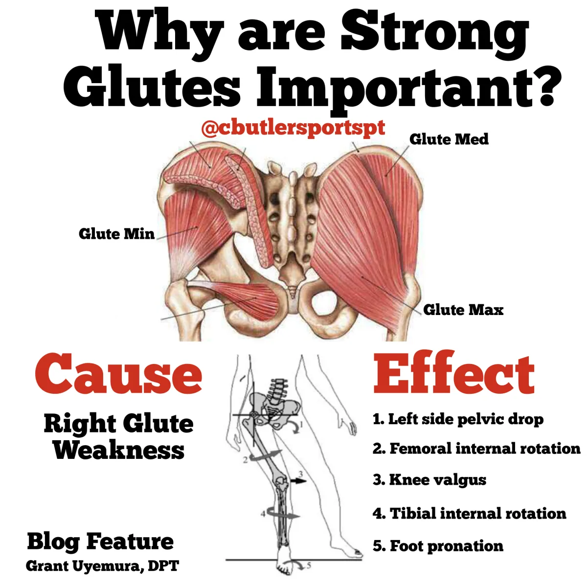Weakness in the glutes affects the entire body.