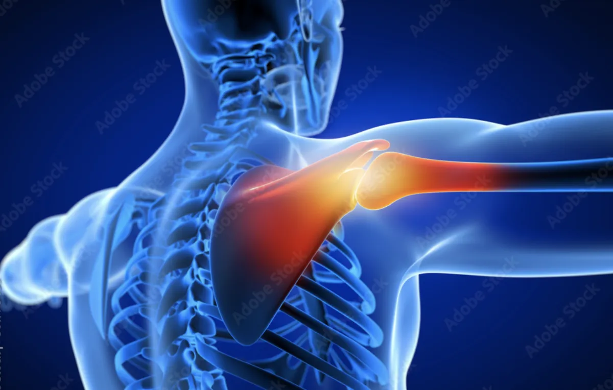 Shoulder injuries often heal with time.