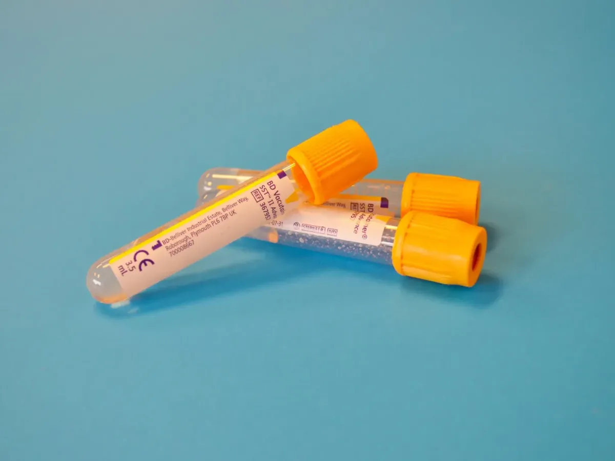 Everything you should know about thyroid testing