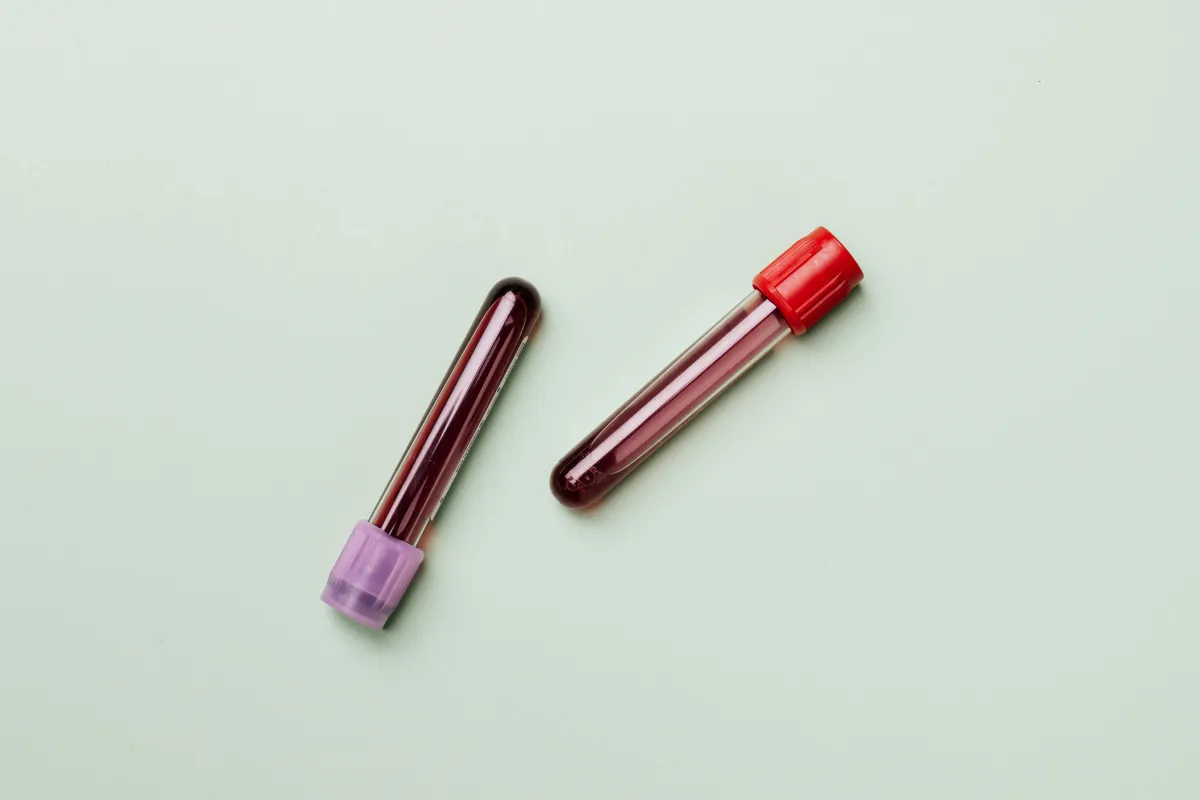 Thyroid Testing