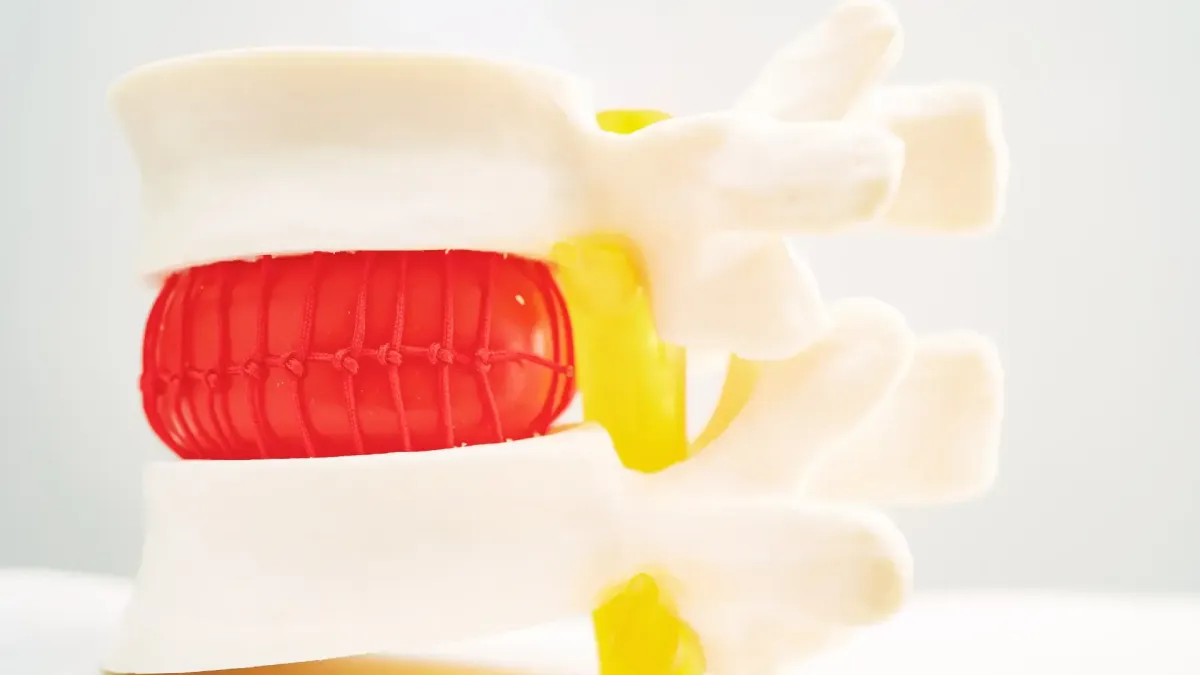 Can a Chiropractor Help with a Herniated Disc?