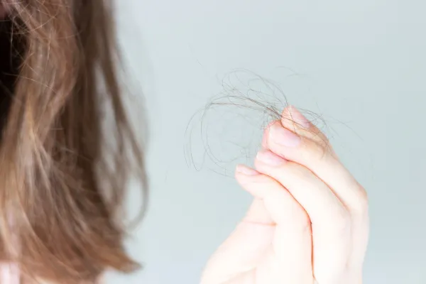 losing hair after bariatric surgery