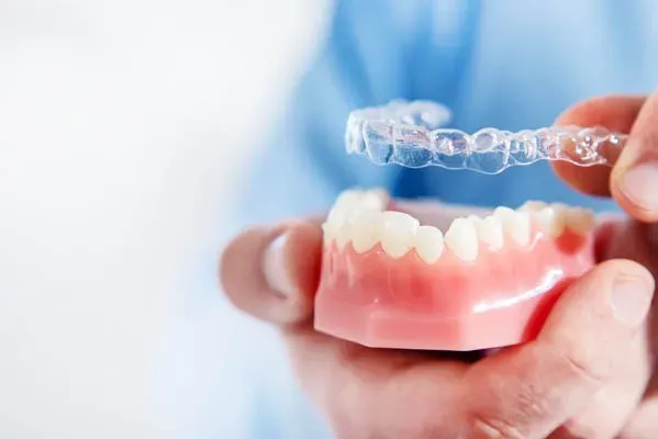 How Invisalign Works: The Science Behind Clear Aligners
