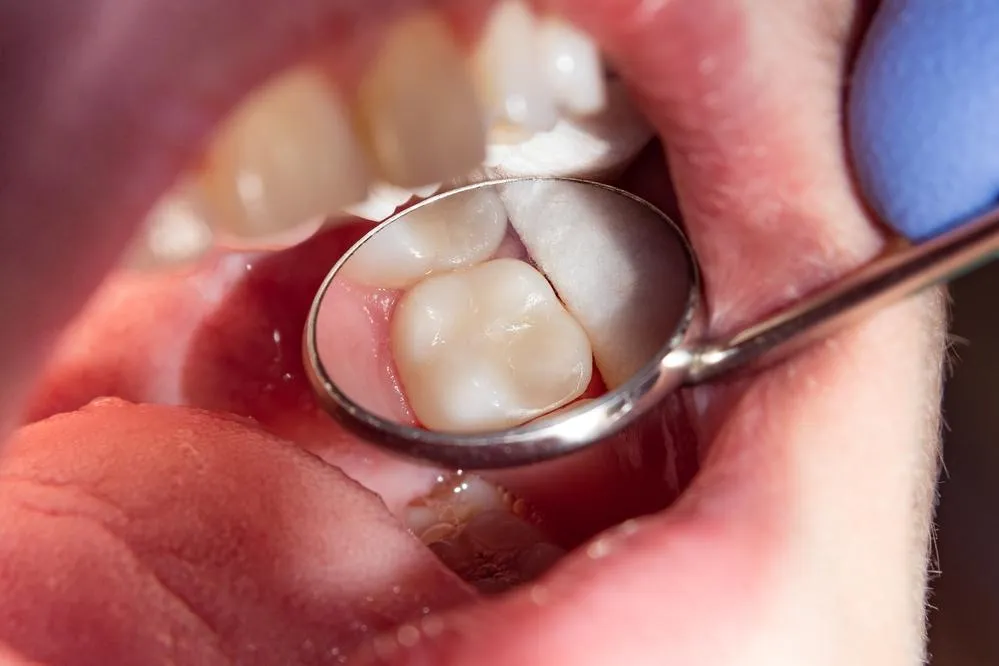 affordable emergency dental care boise