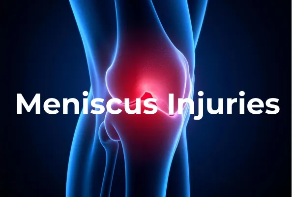 Meniscus Injuries: Surgery vs. Non-Surgical Rehab — What the Evidence Really Says