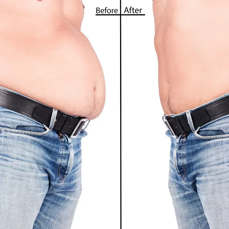before after
