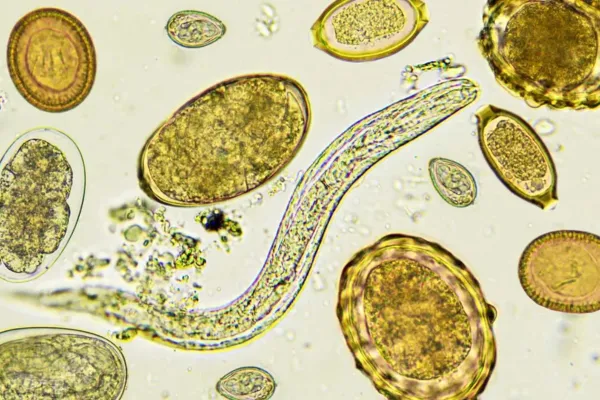 A New Lifestyle Farmer’s Guide to Fecal Egg Counts (FECs)