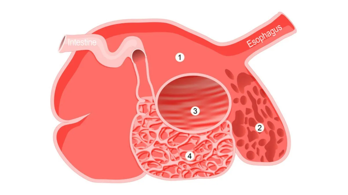 Ruminant's digestive system