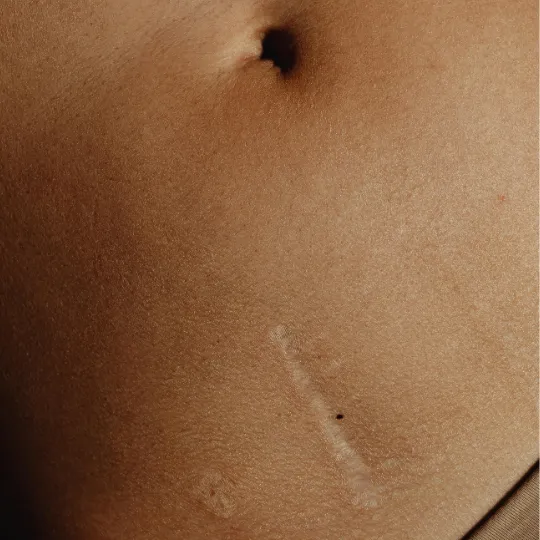 The Beauty of Imperfection: Why Your Flaws Make You Truly Radiant
