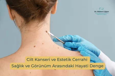 Cilt Kanseri Tedavisinde Estetik Cerrahinin Rolü | Dr. Bülent Çığşar
