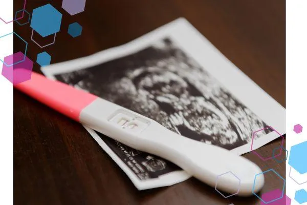 Top 10 Early Pregnancy Questions Answered by an Expert
