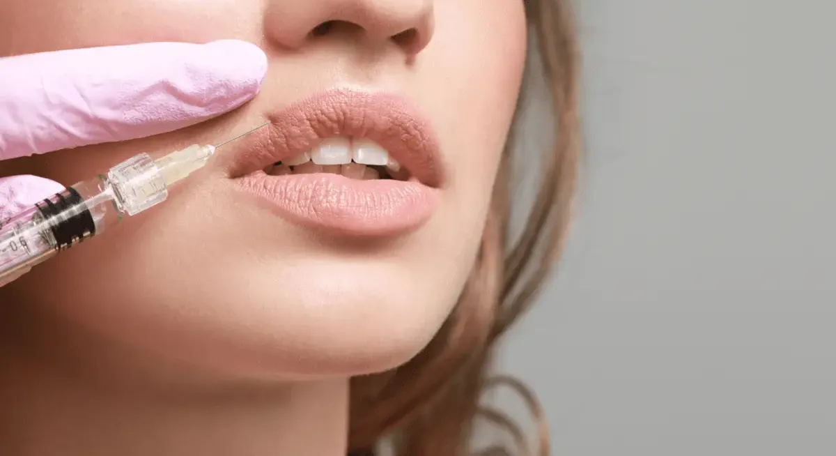 Lip Filler