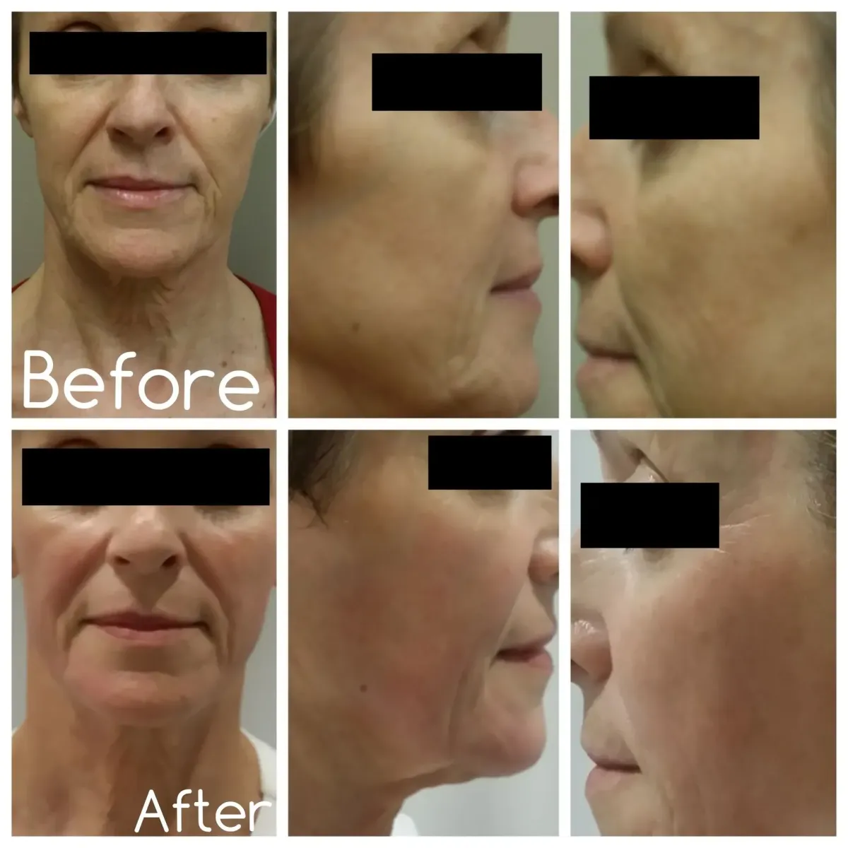 treatment before and after