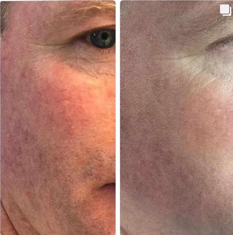 treatment before and after