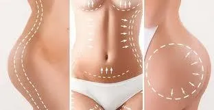 Spot Fat Reduction