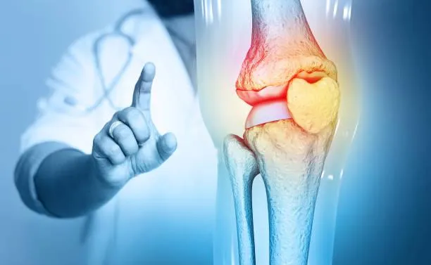 Connective Tissue